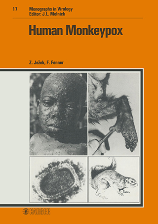 Cover Human Monkeypox