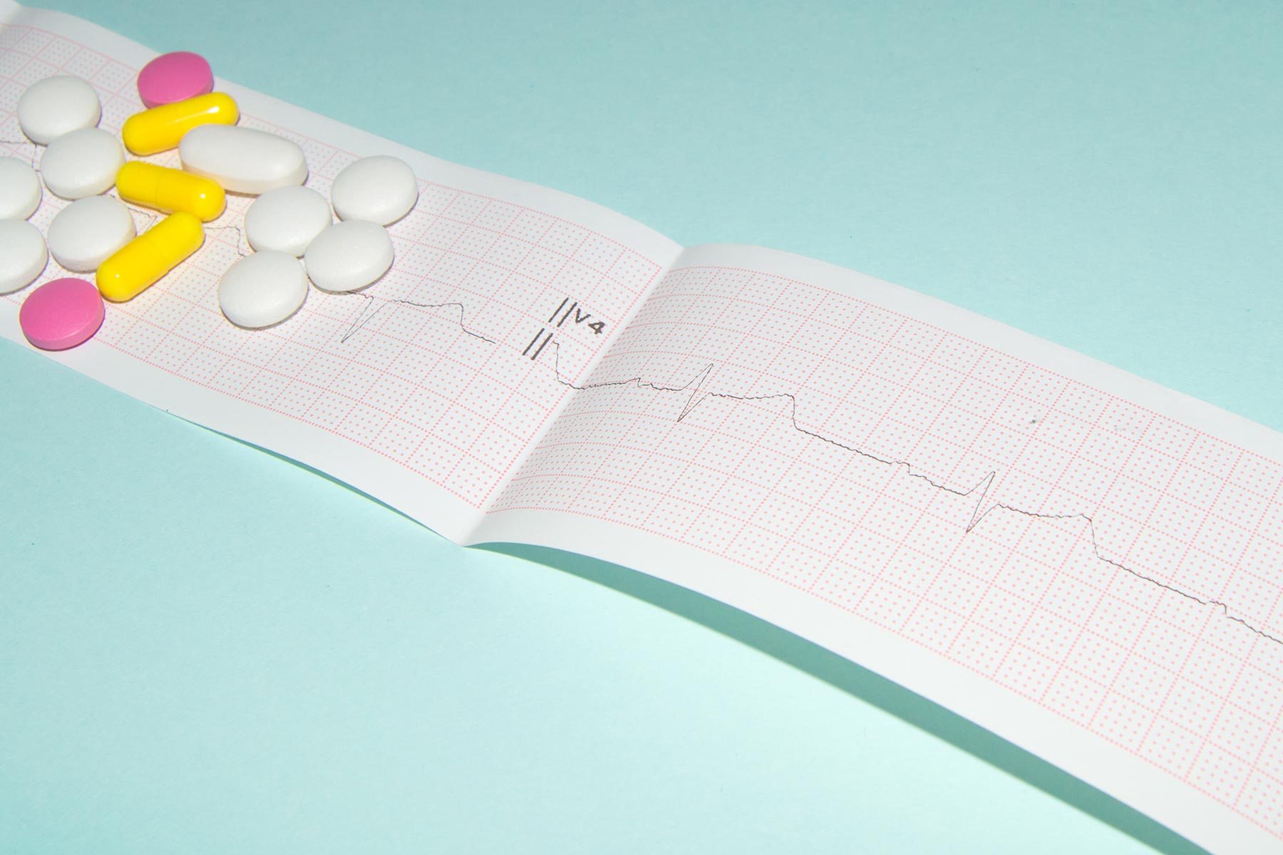 Hero Advances in Pharmacotherapy for Arrhythmia