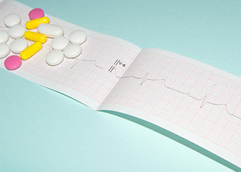 Tile Picture Advances in Pharmacotherapy for Arrhythmia