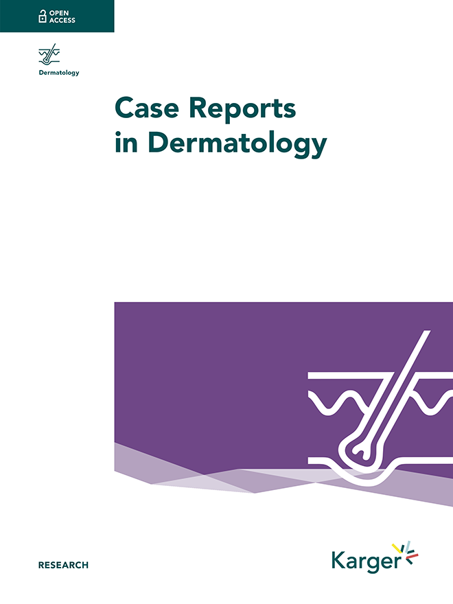 Cover: Case Reports in Dermatology